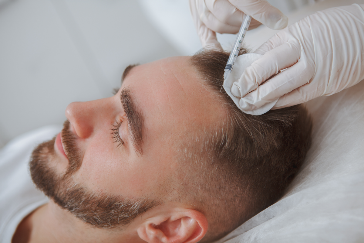 PRP Hair Restoration Therapy Services: A Revolutionary Solution for Hair Loss at Intumedspa