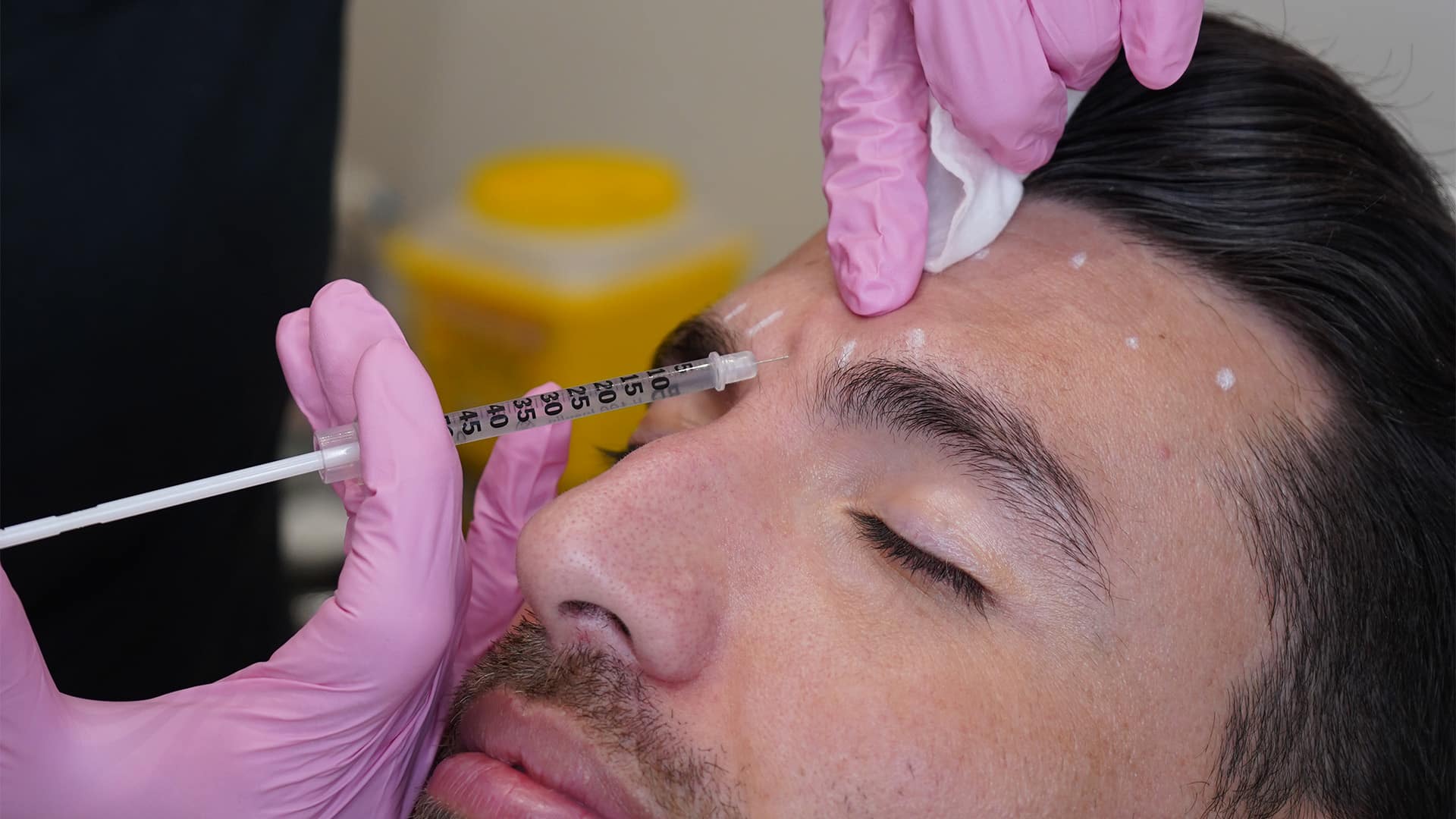 No Longer Just For Wrinkles | New Uses For Botox 1 Botox