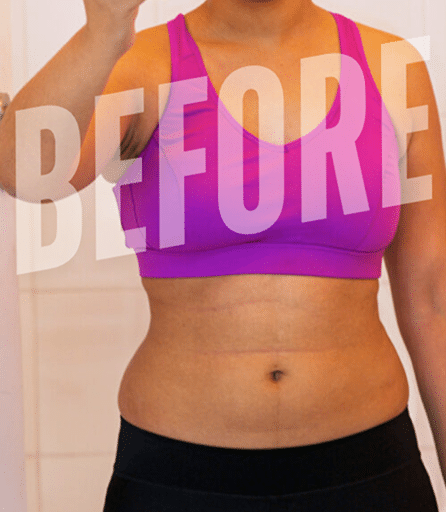 Before Image