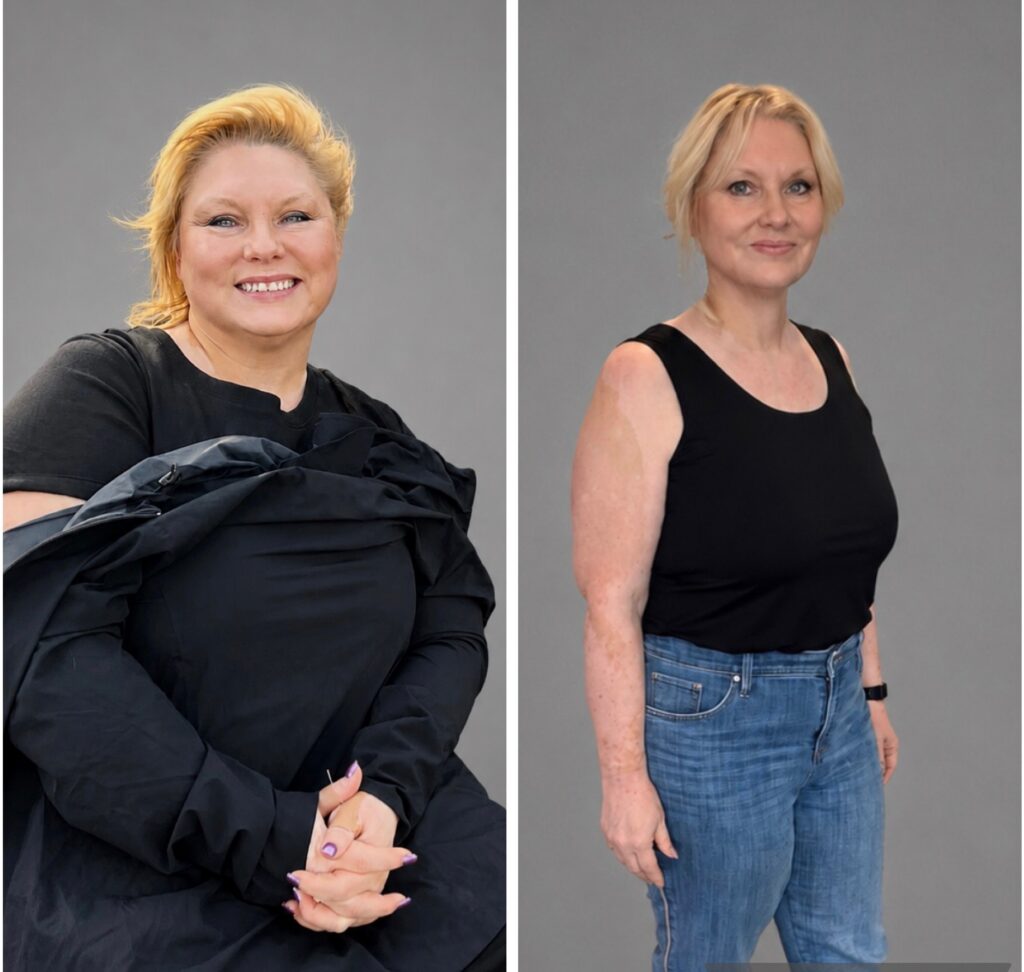 Before and After Image: Weight Loss - front