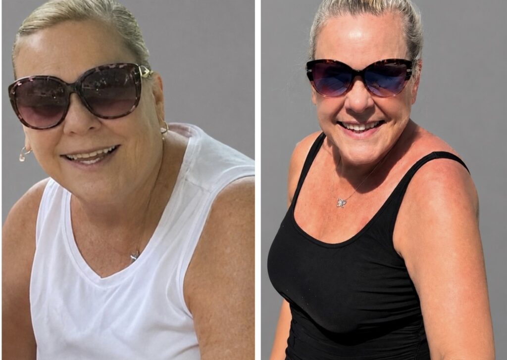 Before and After Image: Weight Loss - front